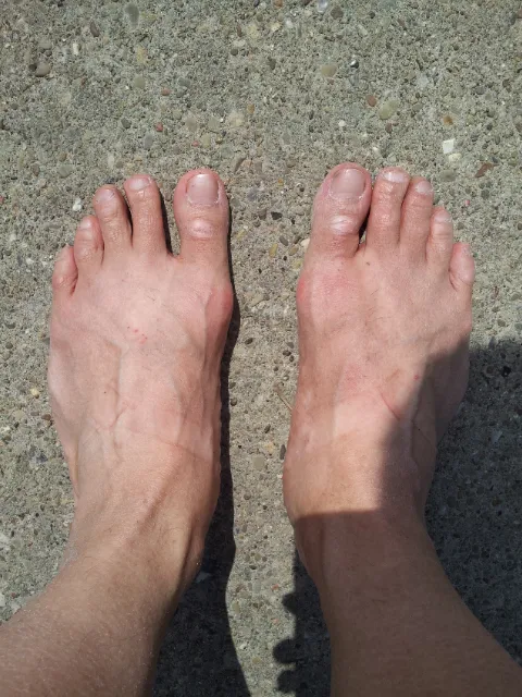 Bare feet