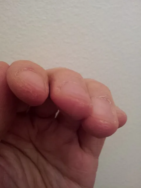 My fingers